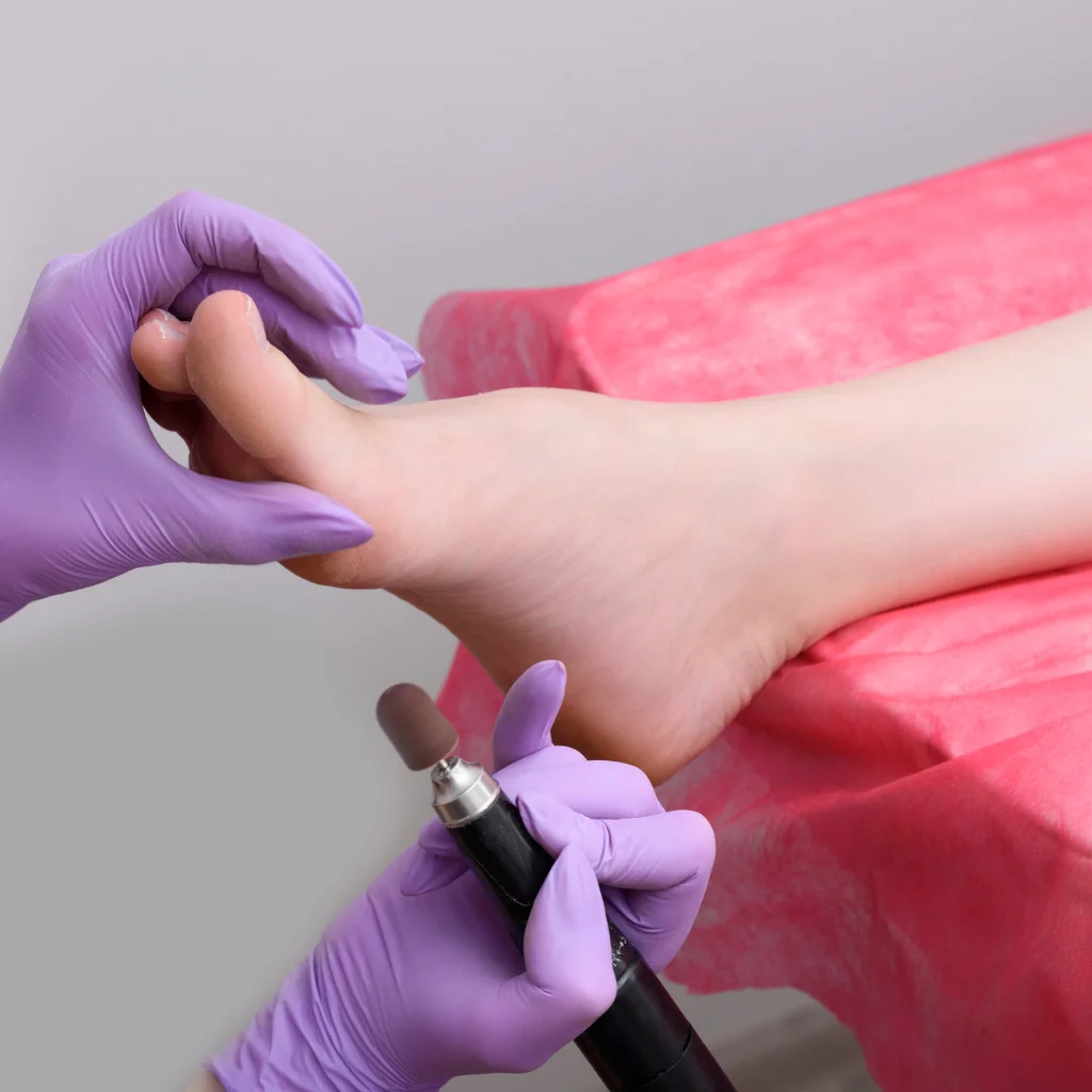 Pedicuratorno